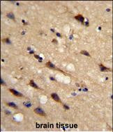 Cyclophilin C Antibody in Immunohistochemistry (Paraffin) (IHC (P))