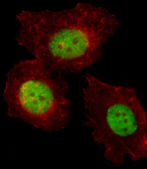 TREF1 Antibody in Immunocytochemistry (ICC/IF)