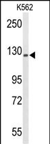 TREF1 Antibody in Western Blot (WB)