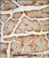 TMEM150A Antibody in Immunohistochemistry (Paraffin) (IHC (P))