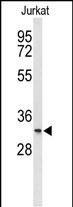 TMEM150A Antibody in Western Blot (WB)