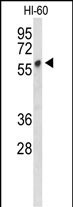 PLVAP Antibody in Western Blot (WB)