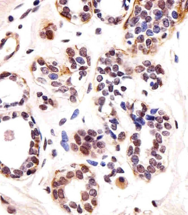 TBX1 Antibody in Immunohistochemistry (Paraffin) (IHC (P))