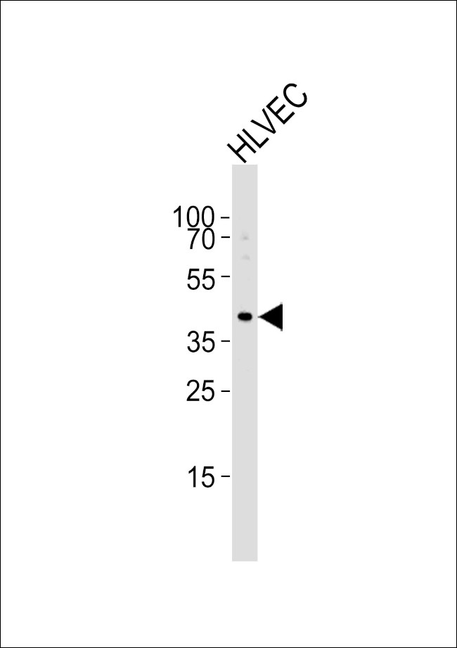 TBX1 Antibody in Western Blot (WB)