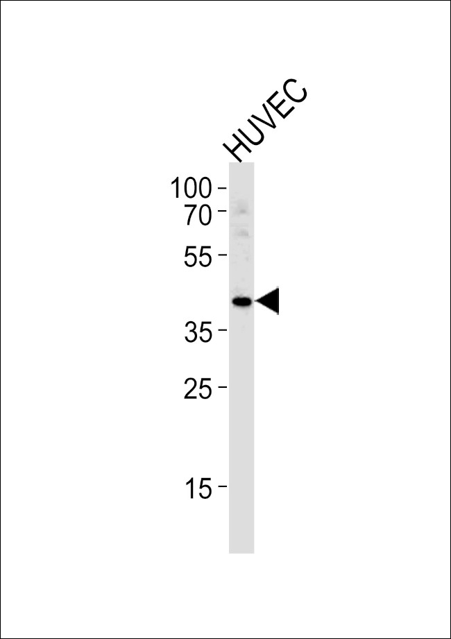 TBX1 Antibody in Western Blot (WB)