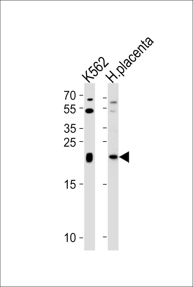 IL-31 Antibody in Western Blot (WB)