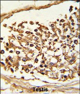 JMJD2B Antibody in Immunohistochemistry (Paraffin) (IHC (P))