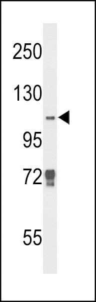 JMJD2B Antibody in Western Blot (WB)