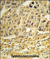 CCNB1IP1 Antibody in Immunohistochemistry (Paraffin) (IHC (P))