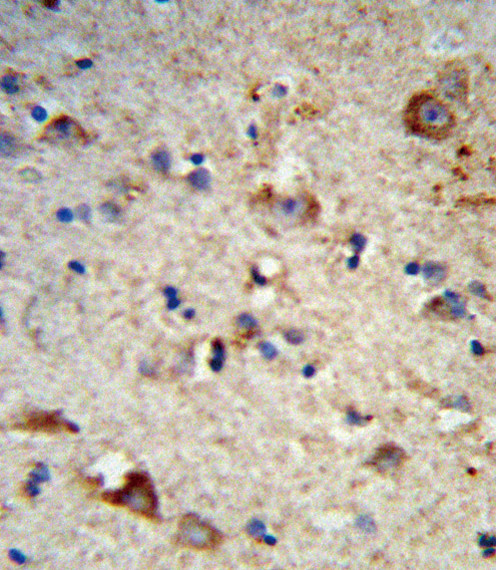 EXT2 Antibody in Immunohistochemistry (Paraffin) (IHC (P))