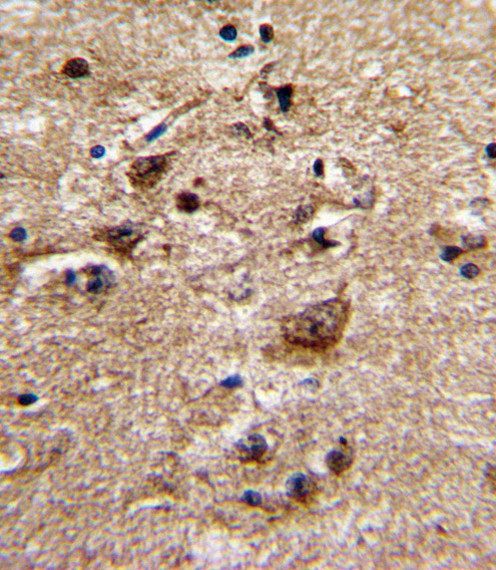 alpha-1b Adrenergic Receptor Antibody in Immunohistochemistry (Paraffin) (IHC (P))