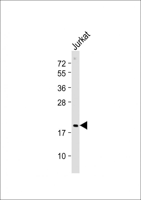 p19 INK4d Antibody in Western Blot (WB)