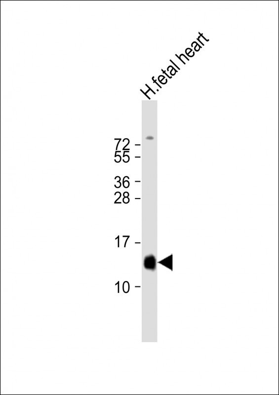 HBA2 Antibody in Western Blot (WB)