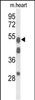 A1BG Antibody in Western Blot (WB)