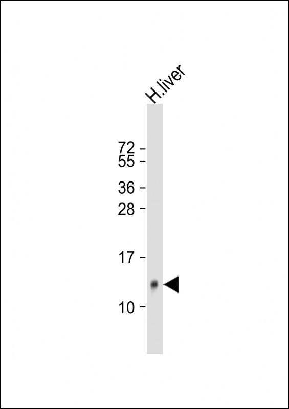 HAMP Antibody in Western Blot (WB)