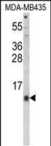 HAMP Antibody in Western Blot (WB)