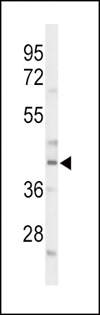 C/EBP alpha Antibody in Western Blot (WB)