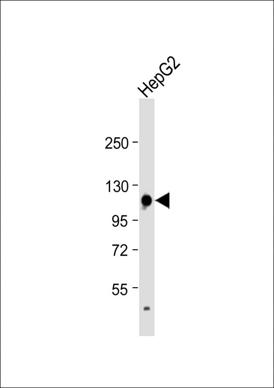 GLDC Antibody in Western Blot (WB)