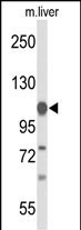 GLDC Antibody in Western Blot (WB)