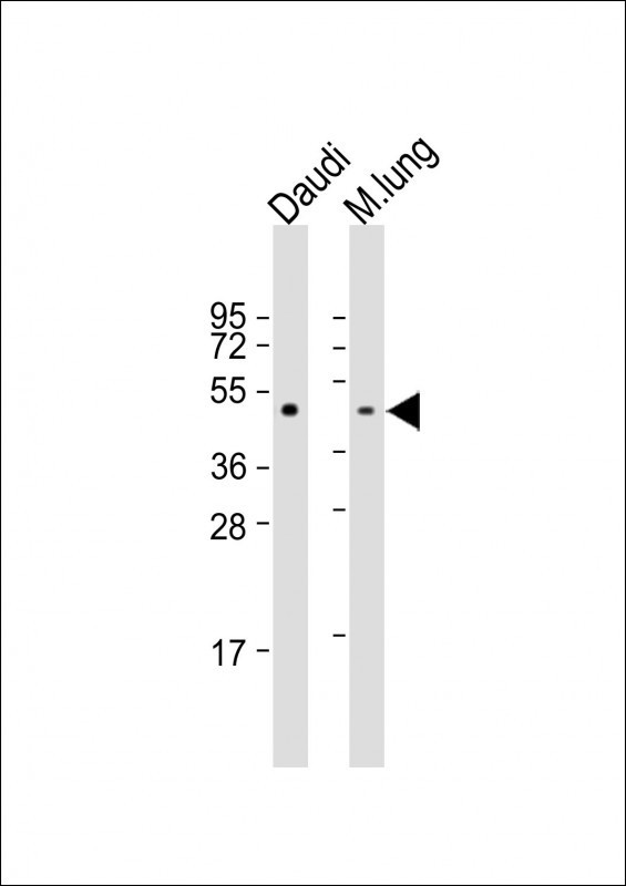 TAT Antibody in Western Blot (WB)