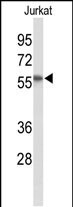 SACM1L Antibody in Western Blot (WB)