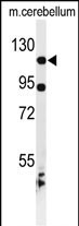 KIF6 Antibody in Western Blot (WB)