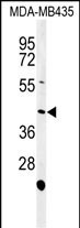 NOXA1 Antibody in Western Blot (WB)