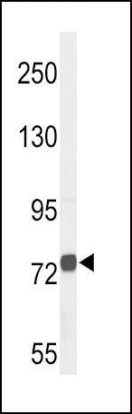 ChAT Antibody in Western Blot (WB)