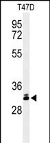 DKK1 Antibody in Western Blot (WB)