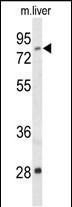 ACSS2 Antibody in Western Blot (WB)