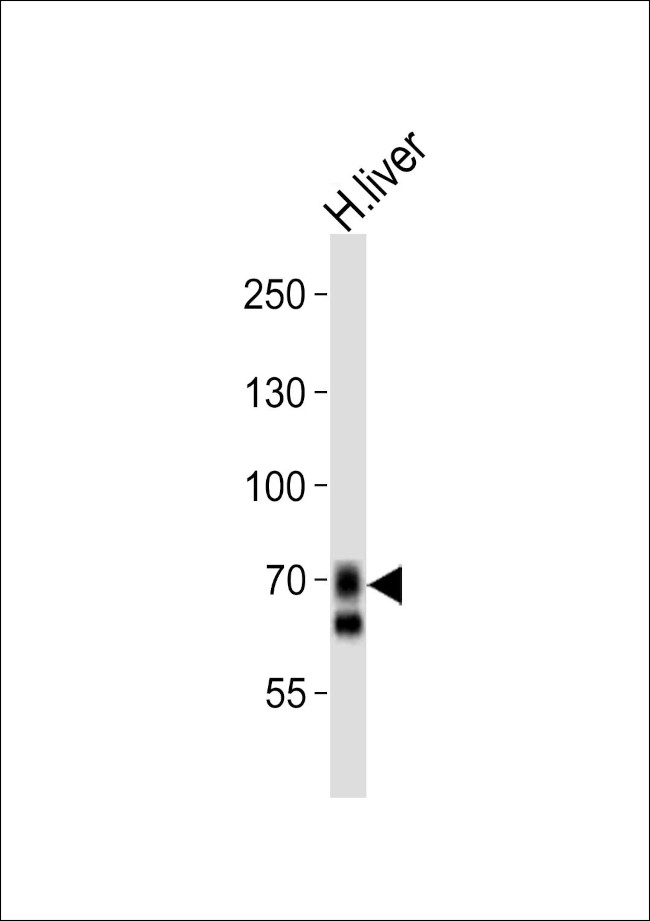 OATP2 Antibody in Western Blot (WB)