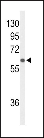 OATP2 Antibody in Western Blot (WB)