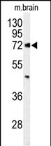 ABCD2 Antibody in Western Blot (WB)