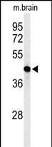 AGPAT6 Antibody in Western Blot (WB)