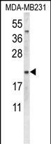 Oxytocin Antibody in Western Blot (WB)