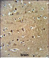 FAM40A Antibody in Immunohistochemistry (Paraffin) (IHC (P))