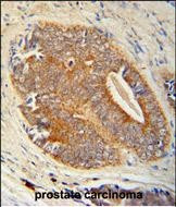 GAGE7 Antibody in Immunohistochemistry (Paraffin) (IHC (P))