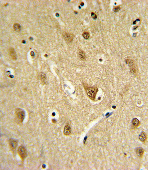 ST8SIA4 Antibody in Immunohistochemistry (Paraffin) (IHC (P))