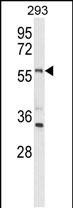 LMBR1L Antibody in Western Blot (WB)