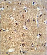 ADAM19 Antibody in Immunohistochemistry (Paraffin) (IHC (P))