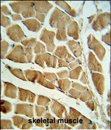 Calpain 3 Antibody in Immunohistochemistry (Paraffin) (IHC (P))