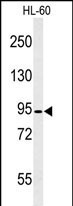 Calpain 3 Antibody in Western Blot (WB)