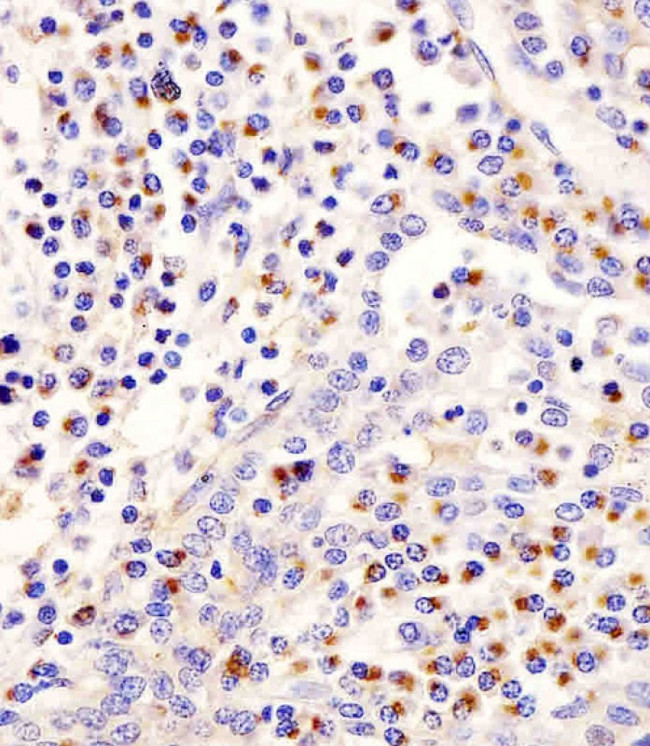 PLA2G7 Antibody in Immunohistochemistry (Paraffin) (IHC (P))