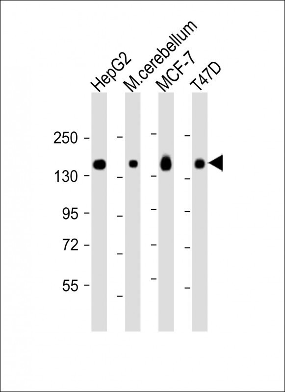 GLG1 Antibody in Western Blot (WB)