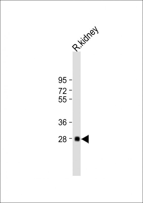 BSND Antibody in Western Blot (WB)