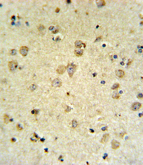 MAP4K3 Antibody in Immunohistochemistry (Paraffin) (IHC (P))