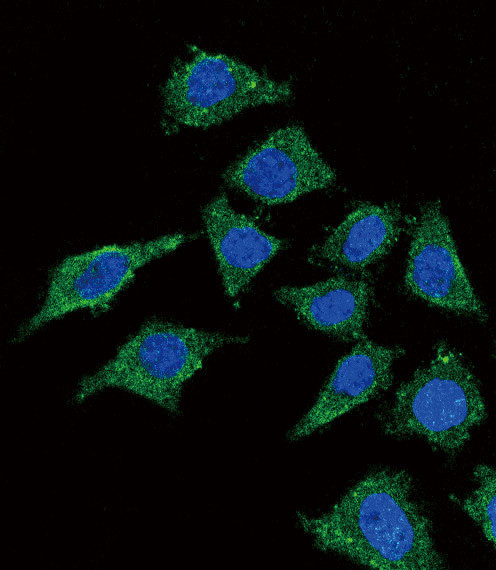 LCAT Antibody in Immunocytochemistry (ICC/IF)