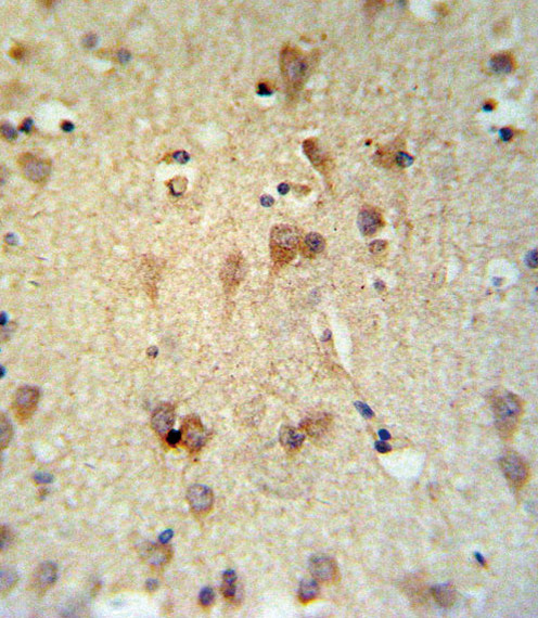 LCAT Antibody in Immunohistochemistry (Paraffin) (IHC (P))