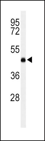 LCAT Antibody in Western Blot (WB)