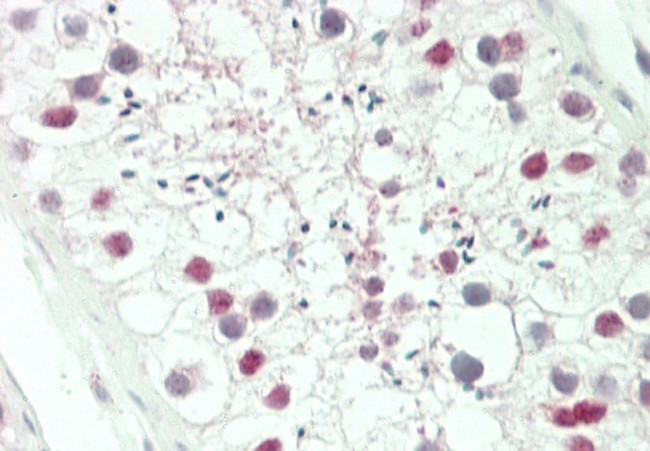 HOXA3 Antibody in Immunohistochemistry (Paraffin) (IHC (P))